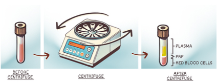 Centrifuge Image